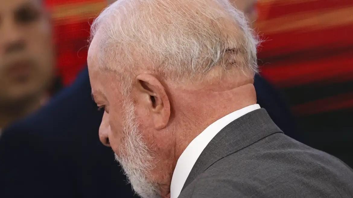 Lula passa por cirurgia às pressas e está internado em UTI após sentir dor de cabeça