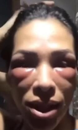 Personal trainer relata ‘ciclo de violência’ com ex-parceiro policial civil; veja vídeo