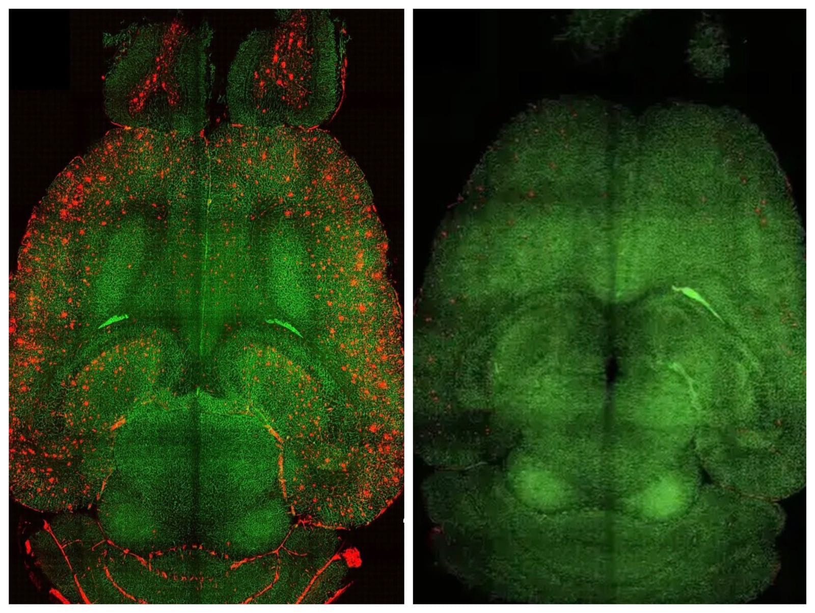 Cientistas testam terapia com nanopartículas que reduz proteína associada ao Alzheimer em laboratório