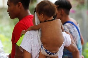 Projeto obriga notificação em casos de desnutrição grave entre indígenas