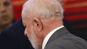 Lula passa por cirurgia às pressas e está internado em UTI após sentir dor de cabeça
