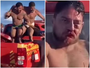 Casal de Mato Grosso é agredido em Porto de Galinhas após cobrança abusiva e denuncia indícios de homofobia