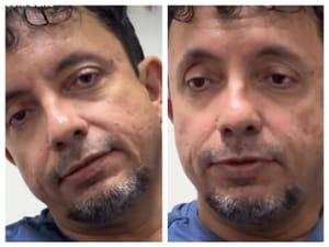 "Grave Traição": Herdeiro do Contorno Leste detona prefeito Abilio Brunini por "se aliar" a invasores e crime organizado após assassinato do pai